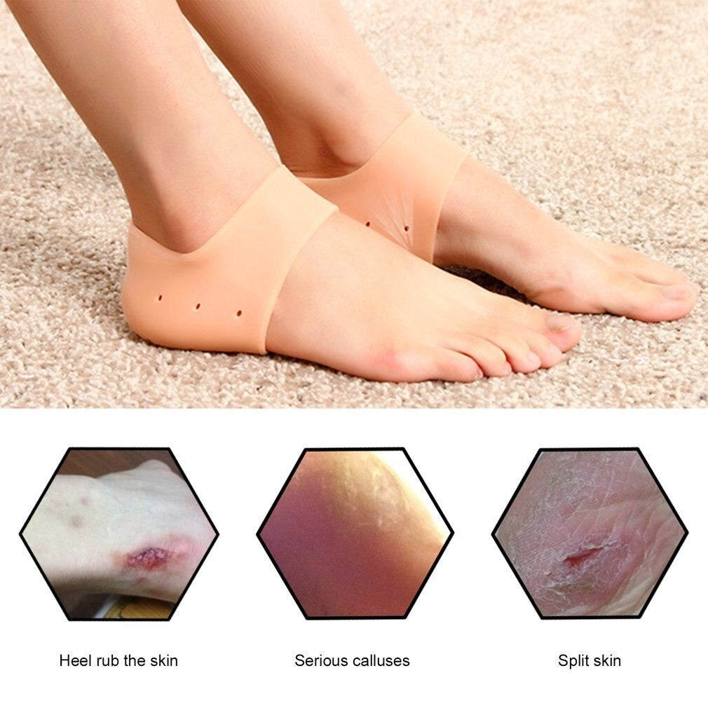 Half Heel Pain Relief & Anti-Crack Silicone Sleeves